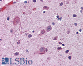 Anti-ACSL4 / FACL4 Antibody (N-Terminus) IHC-plus LS-B5818