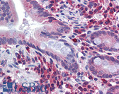 Anti-SPRY2 / Sprouty 2 Antibody (aa107-156) IHC-plus LS-B5819