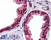 Anti-Alpha-1-Antichymotrypsin Antibody (aa254-303) IHC-plus LS-B5826