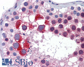 Anti-MTL5 / TESMIN Antibody (aa51-100) IHC-plus LS-B5836