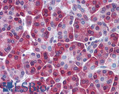 Anti-SQSTM1 Antibody (aa323-372) IHC-plus LS-B5839