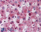 Anti-ATG16L1 / ATG16L Antibody (aa254-303) IHC-plus LS-B5841