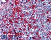 Anti-GSN / Gelsolin Antibody (aa542-591) IHC-plus LS-B5842