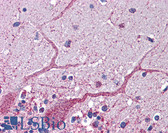Anti-GCLC Antibody (aa74-123) IHC-plus LS-B5844