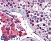 Anti-GNAQ Antibody (aa71-120) IHC-plus LS-B5849