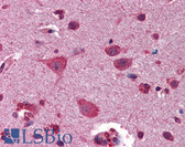 Anti-GSK3B / GSK3 Beta Antibody (aa326-375) IHC-plus LS-B5850