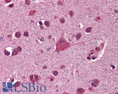 Anti-FKBP5 / FKBP51 Antibody (aa326-375) IHC-plus LS-B5851