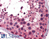 Anti-NAK / TBK1 Antibody (aa74-123) IHC-plus LS-B5859