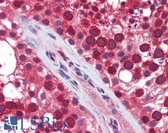 Anti-NAK / TBK1 Antibody (aa539-588) IHC-plus LS-B5860