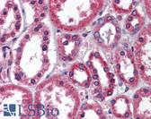 Anti-TBC1 / TBC1D1 Antibody (aa612-661) IHC-plus LS-B5862