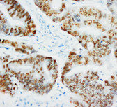 p53 IHC Antibody