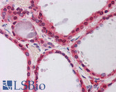 Anti-PPP2R1A Antibody (aa107-156) IHC-plus LS-B5871