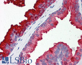 Anti-RAB23 Antibody (aa35-84) IHC-plus LS-B5872