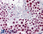 Anti-HNRNPH1 / hnRNP H Antibody (aa360-409) IHC-plus LS-B5874