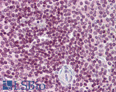 Anti-CDC20 Antibody (N-Terminus) IHC-plus LS-B5877