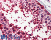 Anti-MDM4 / MDMX Antibody (aa130-179) IHC-plus LS-B5878