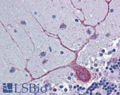 Anti-HIF1A / HIF1 Alpha Antibody (N-Terminus) IHC-plus LS-B5879