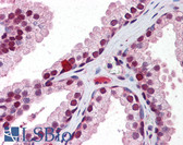 Anti-RXRB Antibody (aa74-123) IHC-plus LS-B5882