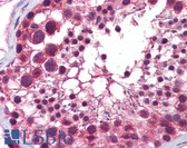 Anti-HDAC6 Antibody (N-Terminus) IHC-plus LS-B5885