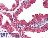 Anti-DYRK / DYRK1A Antibody (aa22-71) IHC-plus LS-B5890