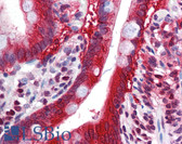 Anti-FTO Antibody (N-Terminus) IHC-plus LS-B5891