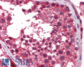 Anti-TERF2IP / RAP1 Antibody (aa142-191) IHC-plus LS-B5895