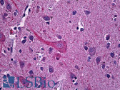 Anti-SYT1 / Synaptotagmin Antibody (Internal) IHC-plus LS-B5899