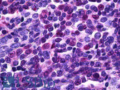 Anti-TFEB Antibody (N-Terminus) IHC-plus LS-B5907