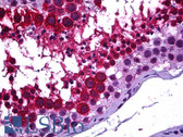 Anti-GALR3 / Galanin Receptor 3 Antibody (C-Terminus) IHC-plus LS-B5913