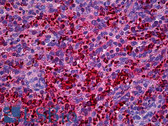 Anti-XCL1 / Lymphotactin Antibody (clone 1E1) IHC-plus LS-B5938