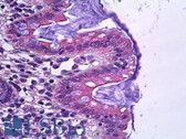 Anti-SLC12A2 / NKCC1 Antibody (Internal) IHC-plus LS-B5941