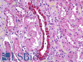 Anti-TGFBI Antibody (Internal) IHC-plus LS-B5942