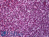 Anti-NCL / Nucleolin Antibody (aa284-709) IHC-plus LS-B5946