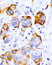 SHP-2 IHC Antibody