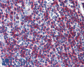 Anti-ADD1 Antibody (C-Terminus, clone EP734Y) IHC-plus LS-B5957