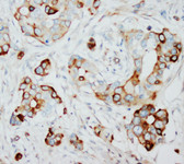 SKP2 (S-phase kinase-associated protein 2) IHC Antibody