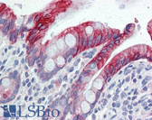 Anti-KRT20 / CK20 / Cytokeratin 20 Antibody (clone IT-Ks 20.10, FITC) IHC-plus LS-B5959