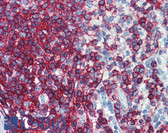 Anti-CD44 Antibody (FITC) IHC-plus LS-B5963