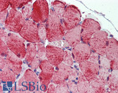 Anti-PLIN5 / OXPAT / LSDP5 Antibody (aa400-463) IHC-plus LS-B5964
