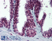 Anti-MDM2 Antibody (phospho-Ser395) IHC-plus LS-B5969