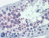 Anti-HURP / DLGAP5 Antibody (aa791-840) IHC-plus LS-B5972
