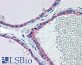 Anti-FGF Receptor / FGFR2 Antibody (aa471-520) IHC-plus LS-B5979
