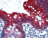 Anti-KRT19 / CK19 / Cytokeratin 19 Antibody (aa231-280) IHC-plus LS-B5980
