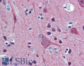 Anti-UCHL1 / PGP9.5 Antibody (aa171-220) IHC-plus LS-B5981