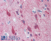 Anti-KCNC2 / Kv3.2 Antibody (aa589-638) IHC-plus LS-B5982