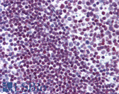 Anti-PARP1 Antibody (Gly623) IHC-plus LS-B5991