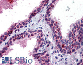 Anti-PADI1 Antibody IHC-plus LS-B5992