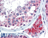 Anti-CDH1 / E Cadherin Antibody (aa1-50) IHC-plus LS-B5995