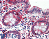Anti-ALDH1A1 / ALDH1 Antibody (clone 1G6) IHC-plus LS-B6003