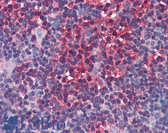 Anti-ARRB2 / Beta Arrestin 2 Antibody (clone 3G1) IHC-plus LS-B6008